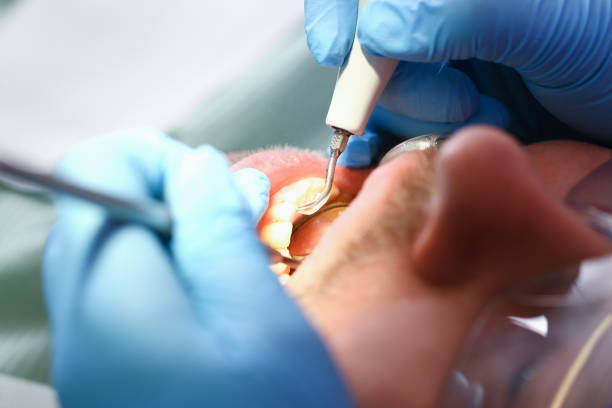 Best Emergency Dental Services for Seniors in Holt, MI