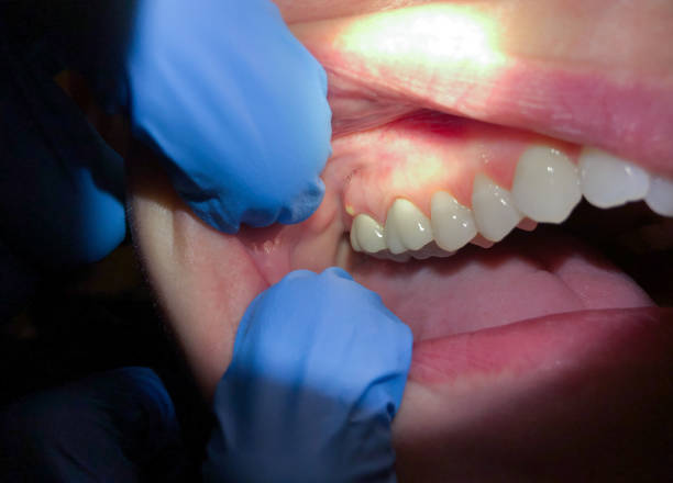 Best Emergency Cosmetic Dentistry in Holt, MI