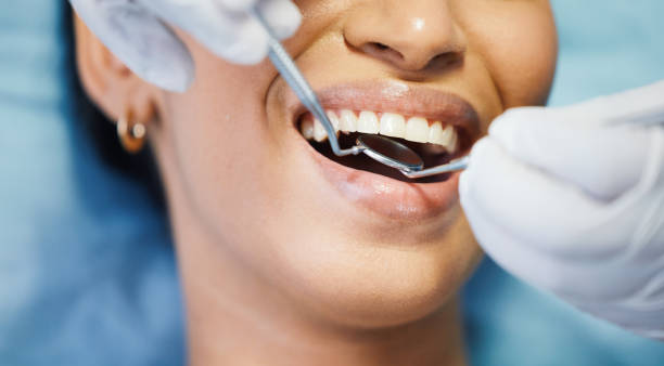 Best Emergency Dentist for Knocked-Out Tooth in Holt, MI